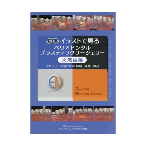 エビデンスに基づいた ペリオドンタルプラスティックサージェリー